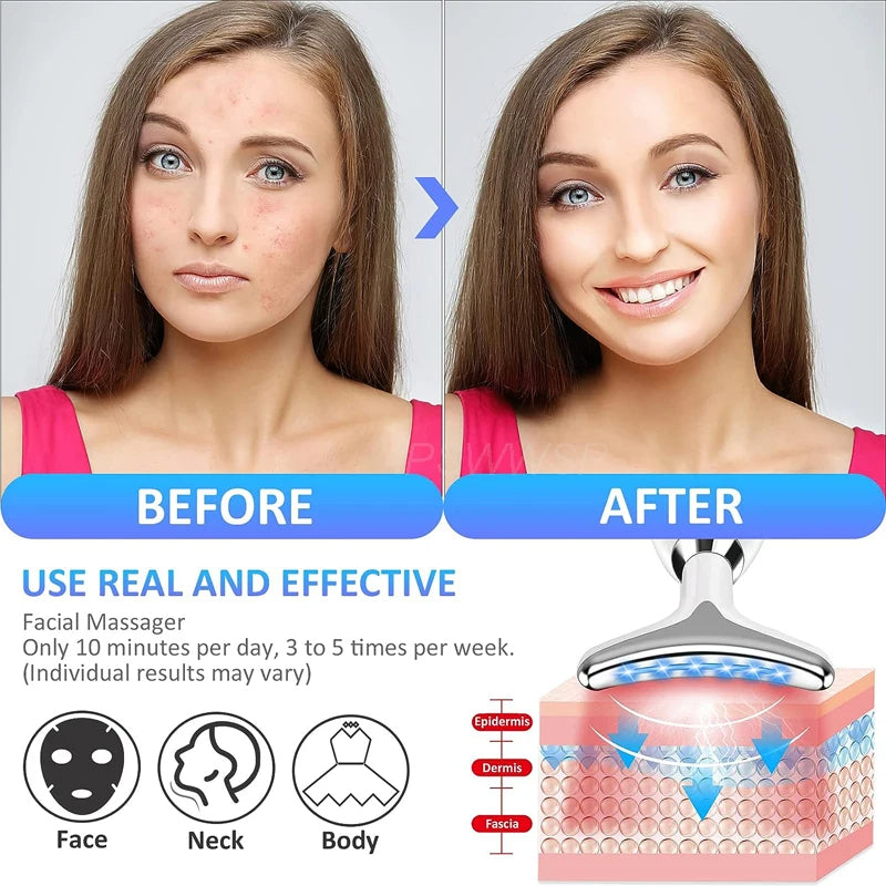 Gloamy™ Face Lifting Device